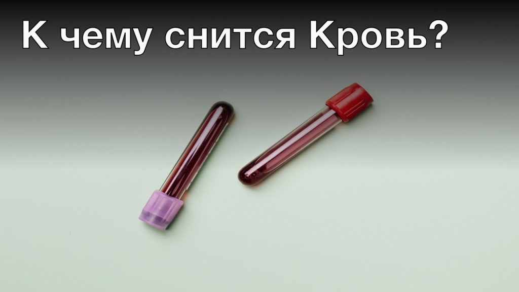 К Чему Снится Кровь: Значение и Толкование Сновидений о Крови